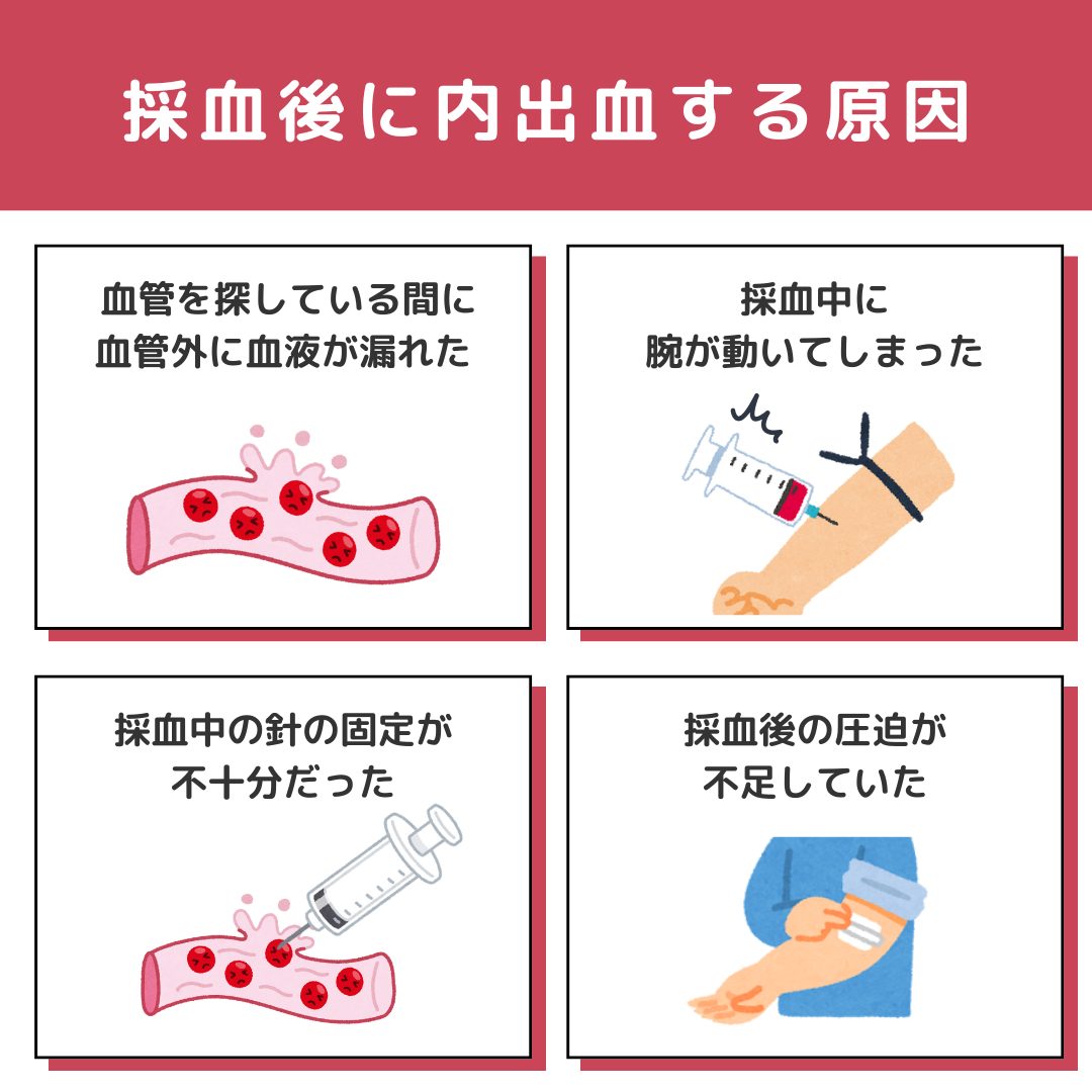 採血 神経 損傷